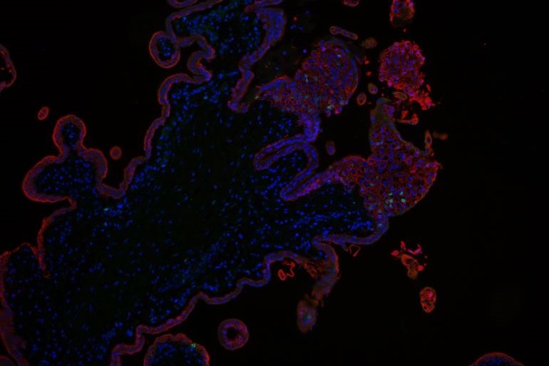Die gefärbten Zellen sind Trophoblasten des Plazentagewebes. © Rabia Anwar
